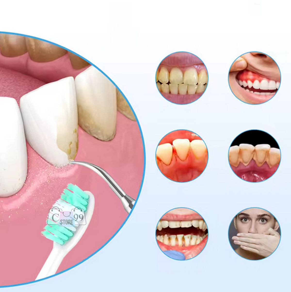 Miniatura 2 de Cepillo De Dientes y Eliminador De sarro